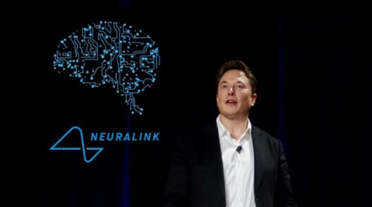 Elon Musk Bakal Tanamkan Chip di Otak Manusia, Apa Tujuannya?