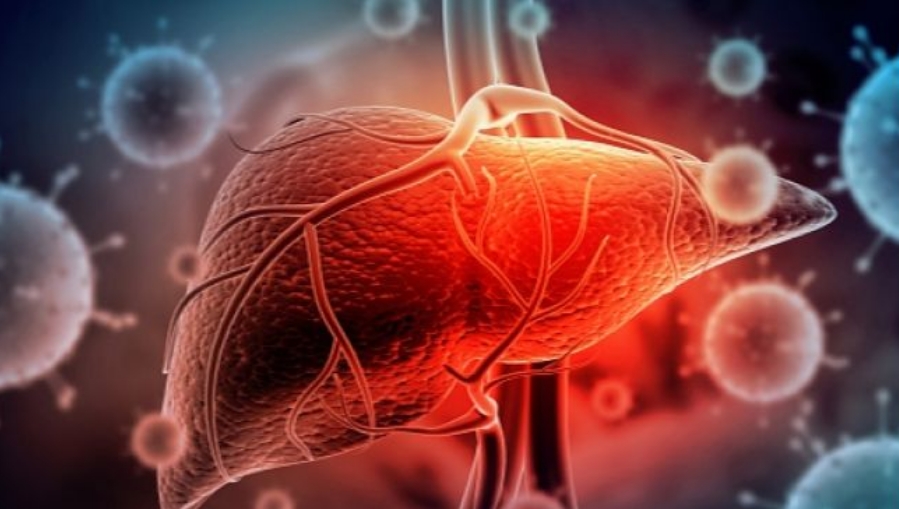Perbedaan Hepatitis Akut Misterius dan Hepatitis Biasa