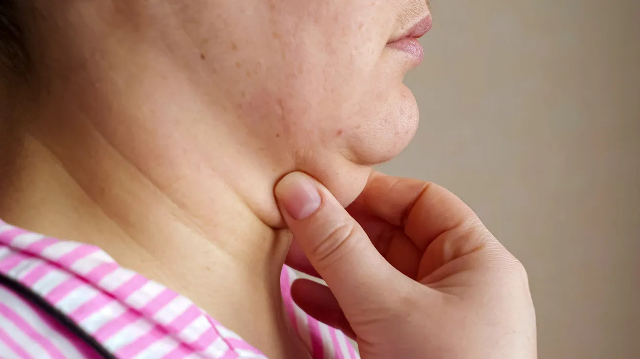 Wajib Coba! Ini 5 Cara Menghilangkan Double Chin