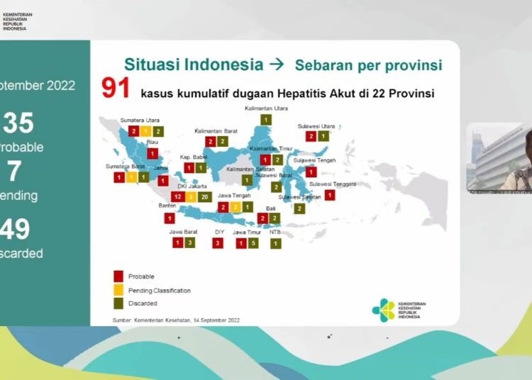 Kemenkes Laporkan 91 Kasus Dugaan Hepatitis Akut